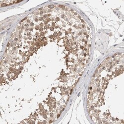 LASS3 Antibody, Novus Biologicals 0.1mL; Unlabeled:Antibodies, Polyclonal
